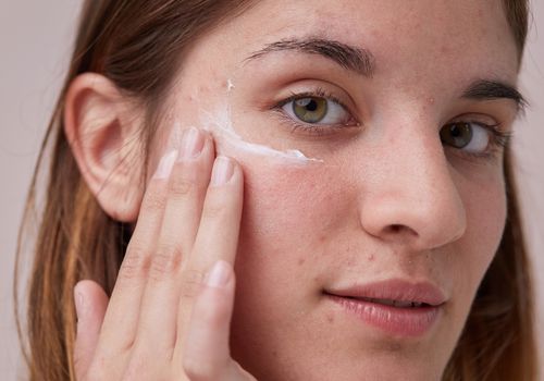 Como obter uma pele de vidro quando você também está lidando com acne (é possível)