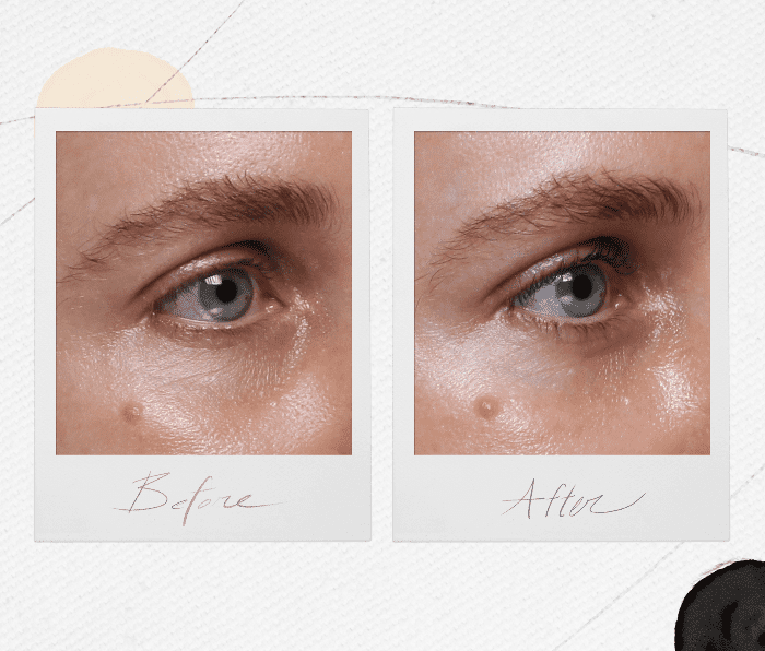 under øjenfyldere — før og efter