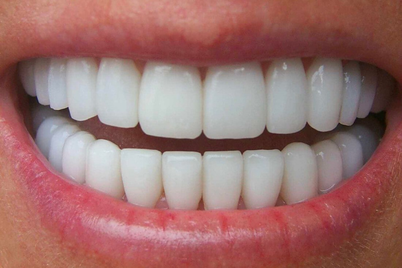 Кой има най-белите зъби?