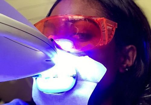 albirea dinților cu laser