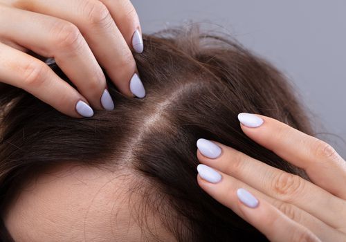 Plazmos įšvirkštimas į galvos odą gali pakeisti plaukų slinkimą - štai kaip