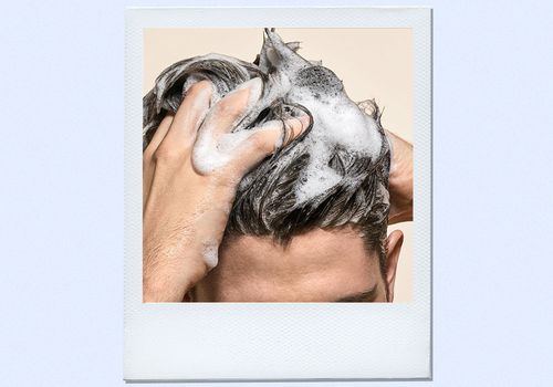 6 spôsobov schválených odborníkmi na prevenciu a ošetrenie ustupujúcej vlasovej línie - ak chcete