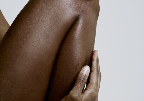 Kako se riješiti kvrga, prema stručnjacima za njegu kože
