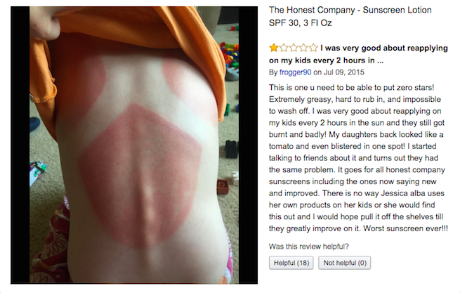 Die Leute sagen, dass sie schreckliche Sonnenbrände von Jessica Albas ehrlicher Sonnencreme bekommen