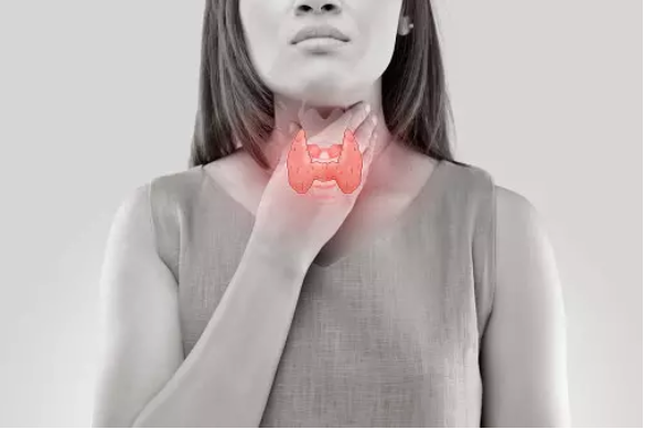 Болест на Грейвс: 10 факта за това автоимунно заболяване, което атакува щитовидната жлеза