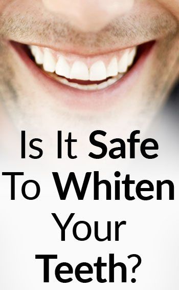 5 nasvetov za varno beljenje zob | Je beljenje zob škodljivo?