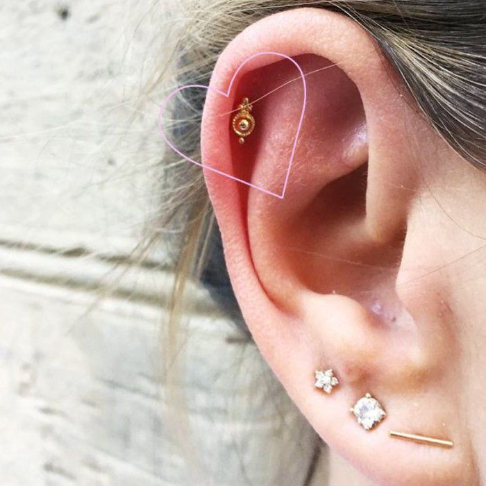 Beispiel eines Ohres mit einem Helix-Piercing