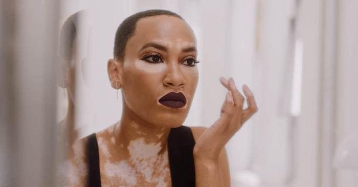 CoverGirls nye kampagnemodel fejrer mangfoldighed gennem hendes Vitiligo