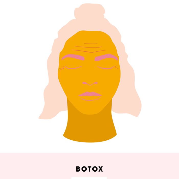 Ilustración de rostro de mujer con botox