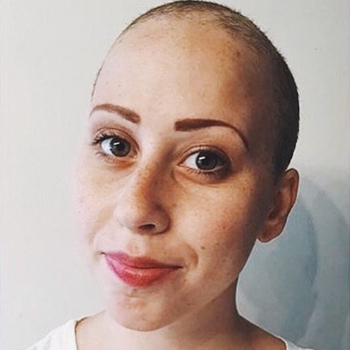 Uma jovem sobrevivente de câncer nos diz 8 ingredientes de beleza que ela nunca mais usará
