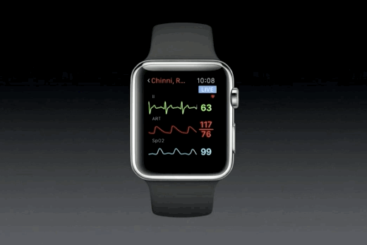 Apple Watch- ը կարող է երեխայի սրտի բաբախյունը տարբերել իր մայրիկի սրտից
